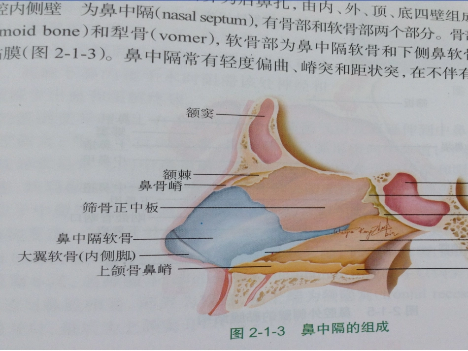 鼻中隔偏曲症_第3页