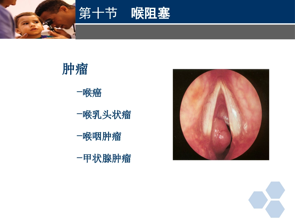 临床医学耳鼻喉科喉阻塞_第10页