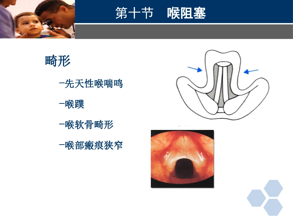 临床医学耳鼻喉科喉阻塞_第11页