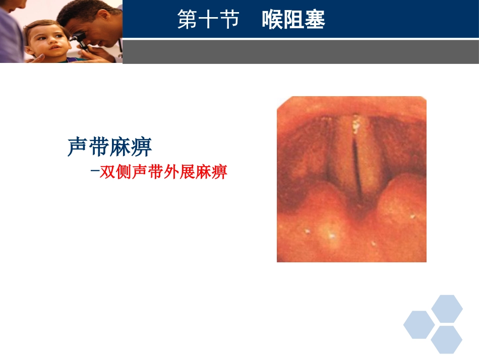 临床医学耳鼻喉科喉阻塞_第12页