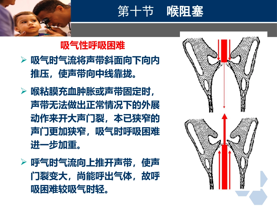 临床医学耳鼻喉科喉阻塞_第14页