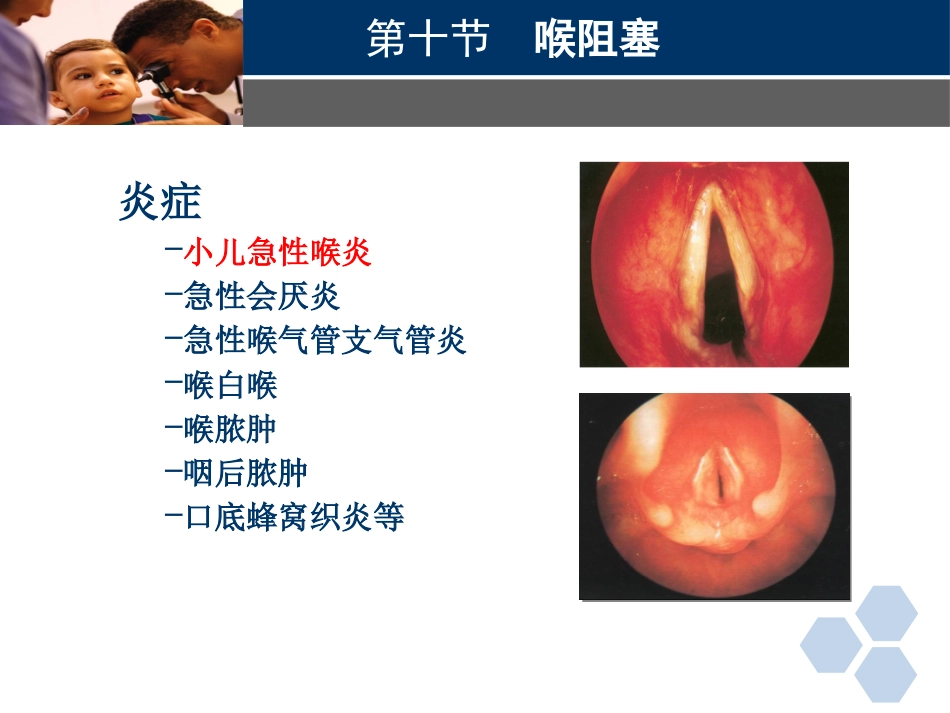 临床医学耳鼻喉科喉阻塞_第3页