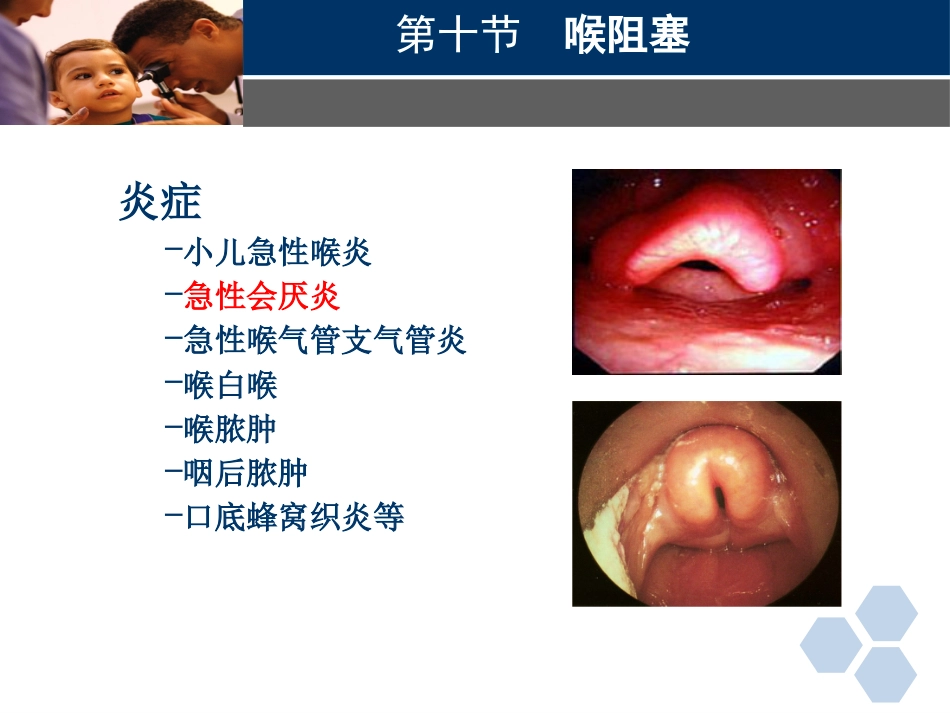临床医学耳鼻喉科喉阻塞_第4页