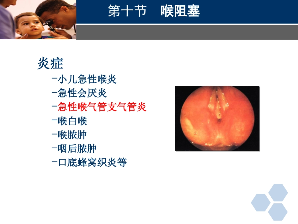 临床医学耳鼻喉科喉阻塞_第5页