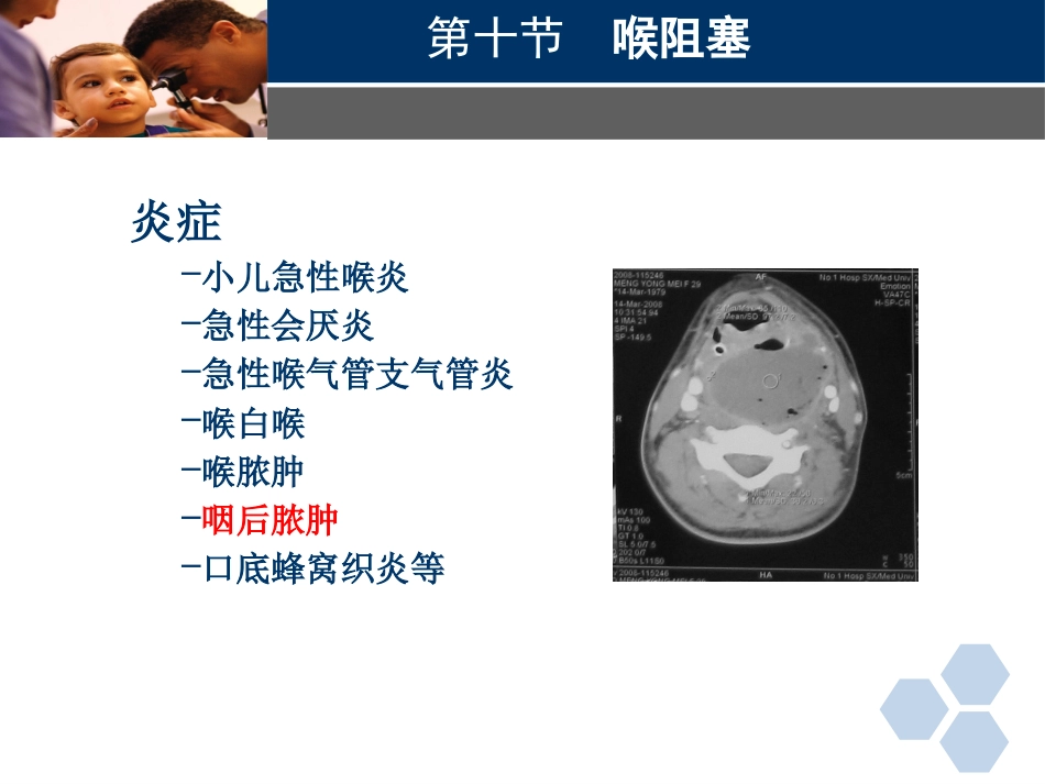 临床医学耳鼻喉科喉阻塞_第6页