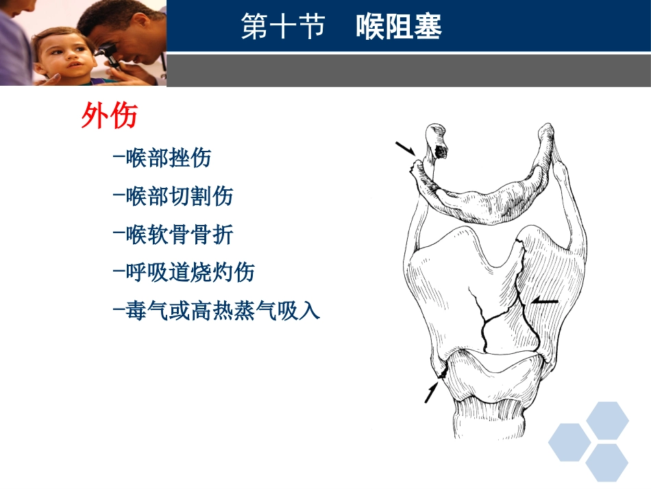 临床医学耳鼻喉科喉阻塞_第7页