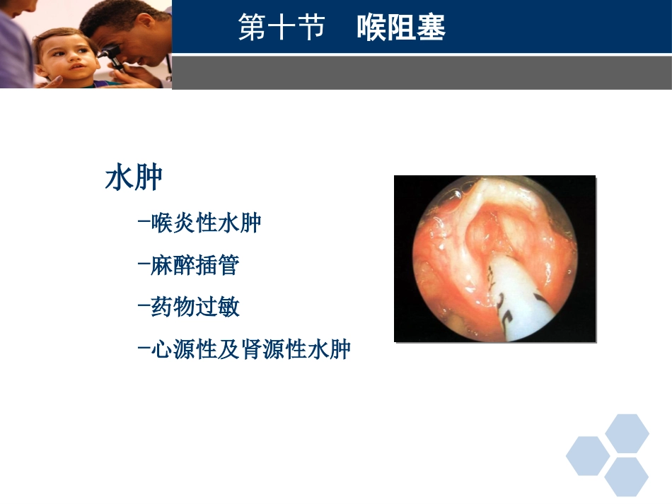 临床医学耳鼻喉科喉阻塞_第9页
