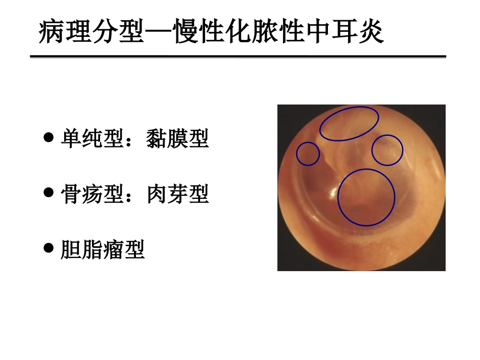慢性化脓性中耳炎(邱建华)_第7页