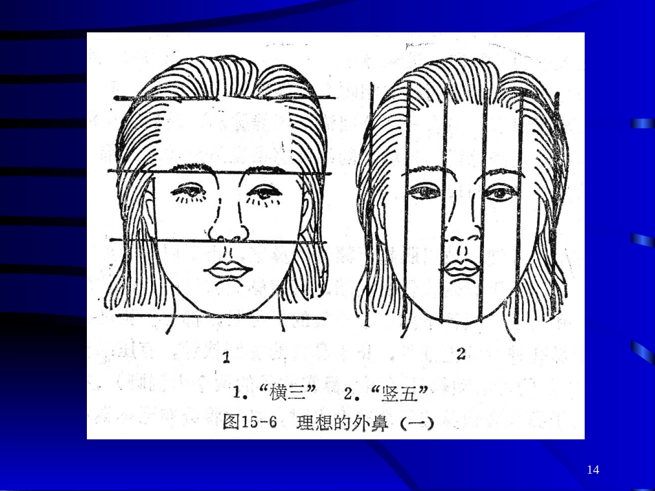 鼻部常见的美容与整形_第14页