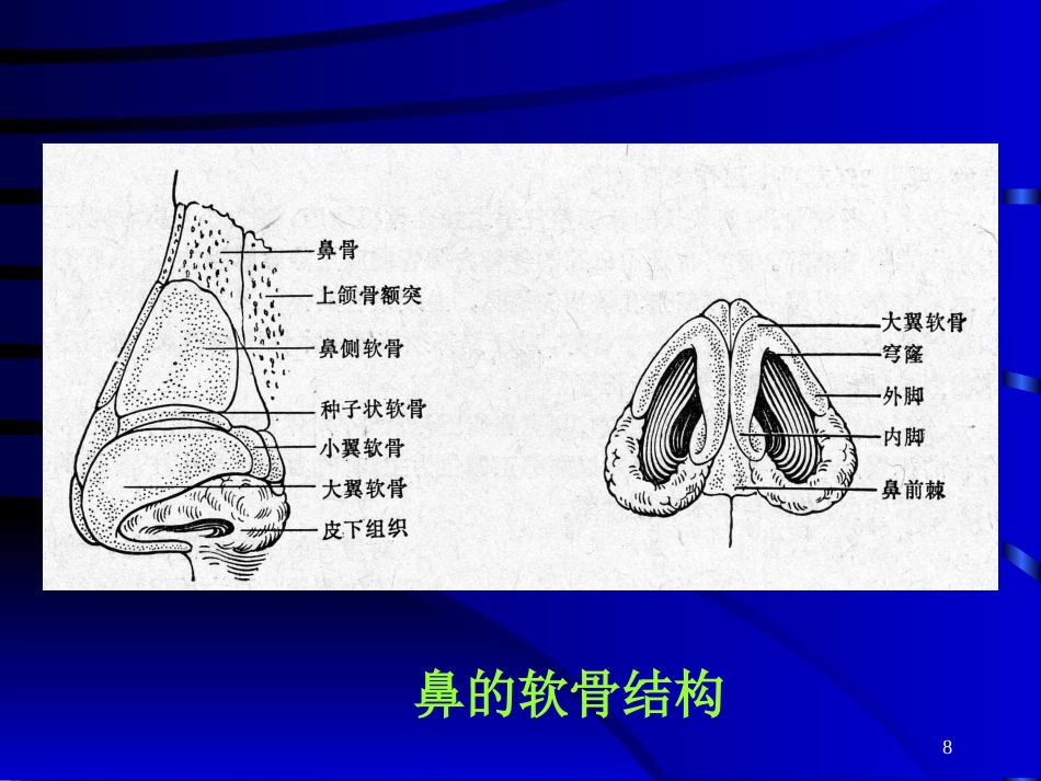 鼻部常见的美容与整形_第8页