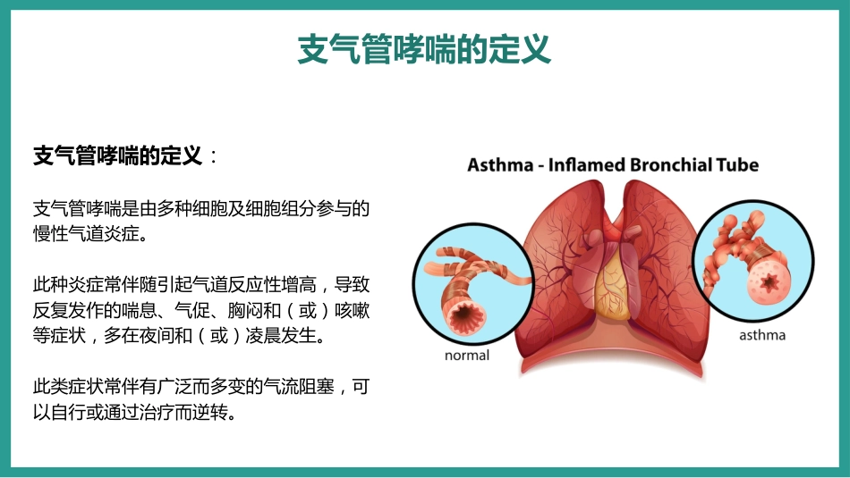 支气管哮喘的预防和治疗_第5页