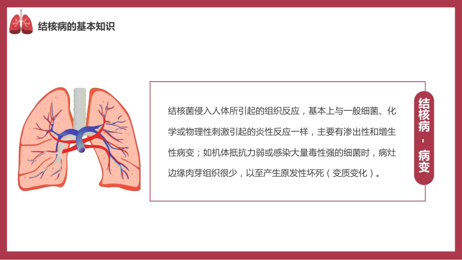 肺结核防治_第5页
