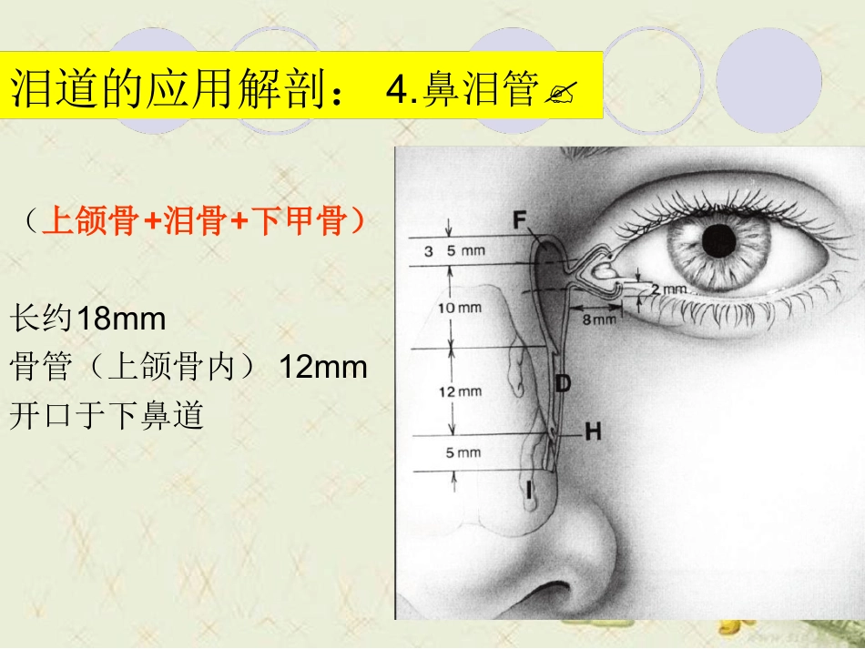 泪道病及鼻内镜下鼻腔泪囊吻合术最新优质PPT课件_第12页
