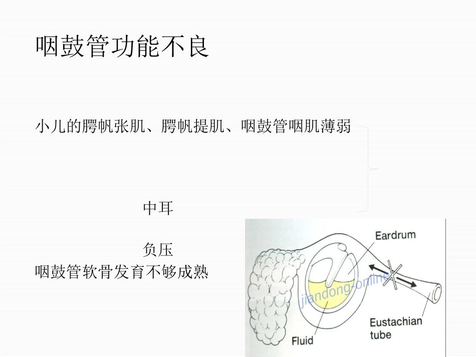分泌性中耳炎中文_第7页
