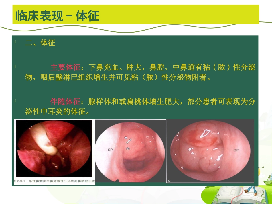 儿童鼻-鼻窦炎诊断和治疗建议_第8页