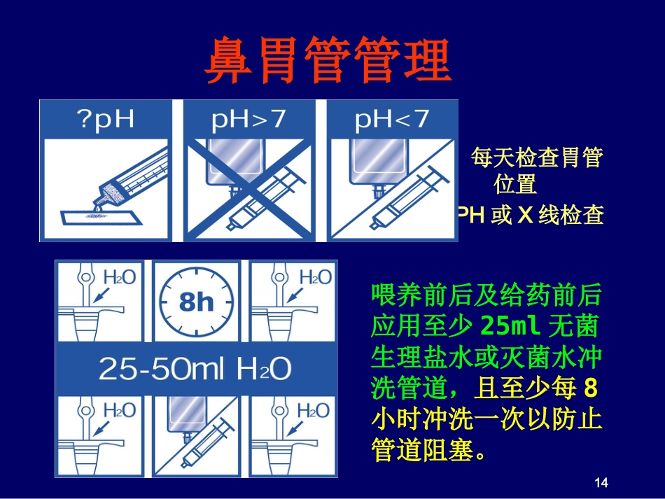 鼻胃肠管盲插方法及管理_第14页