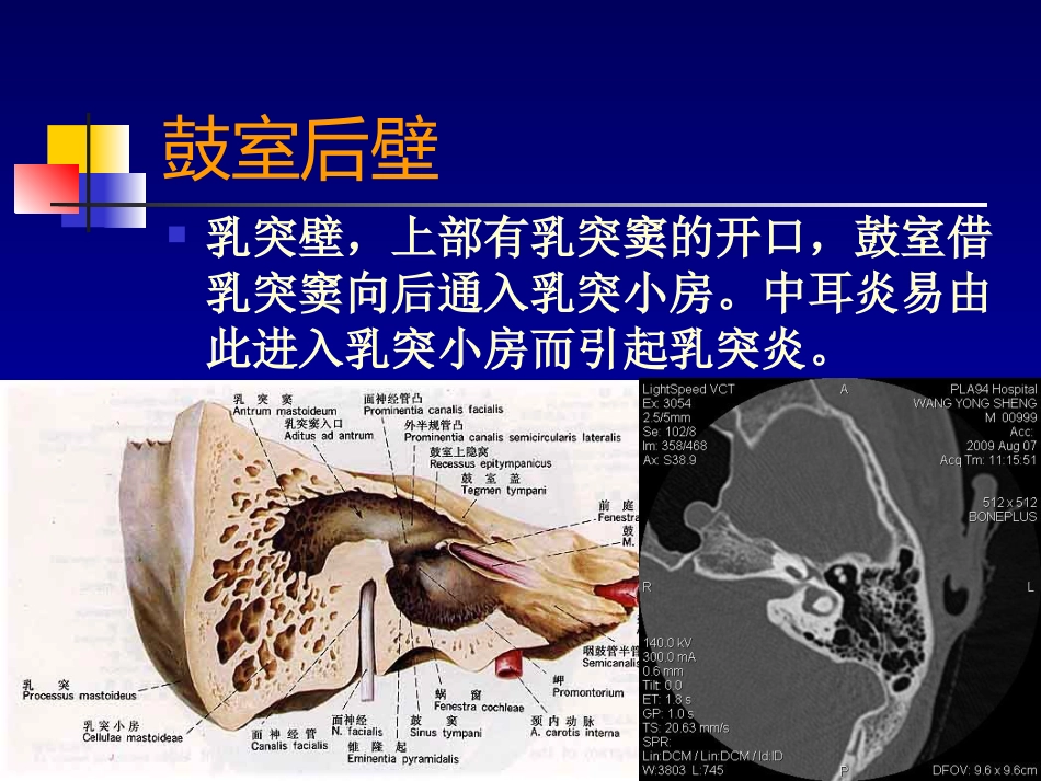 耳部病变MR诊断_第12页