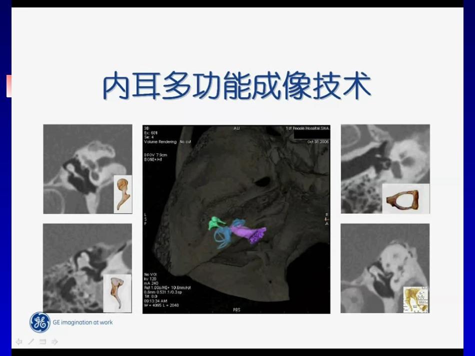 耳部病变MR诊断_第2页