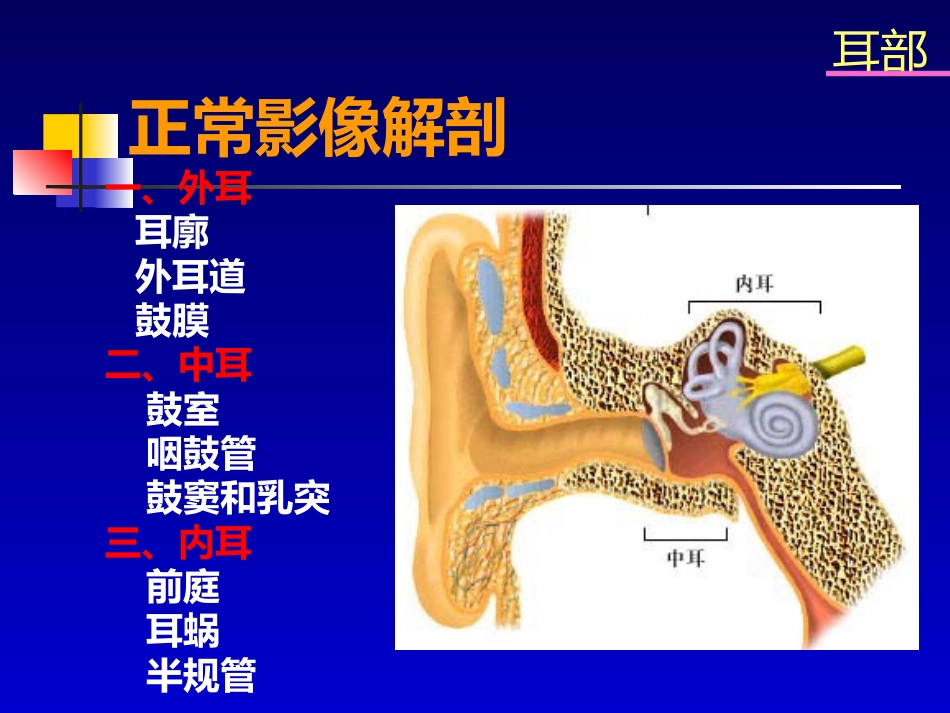 耳部病变MR诊断_第4页