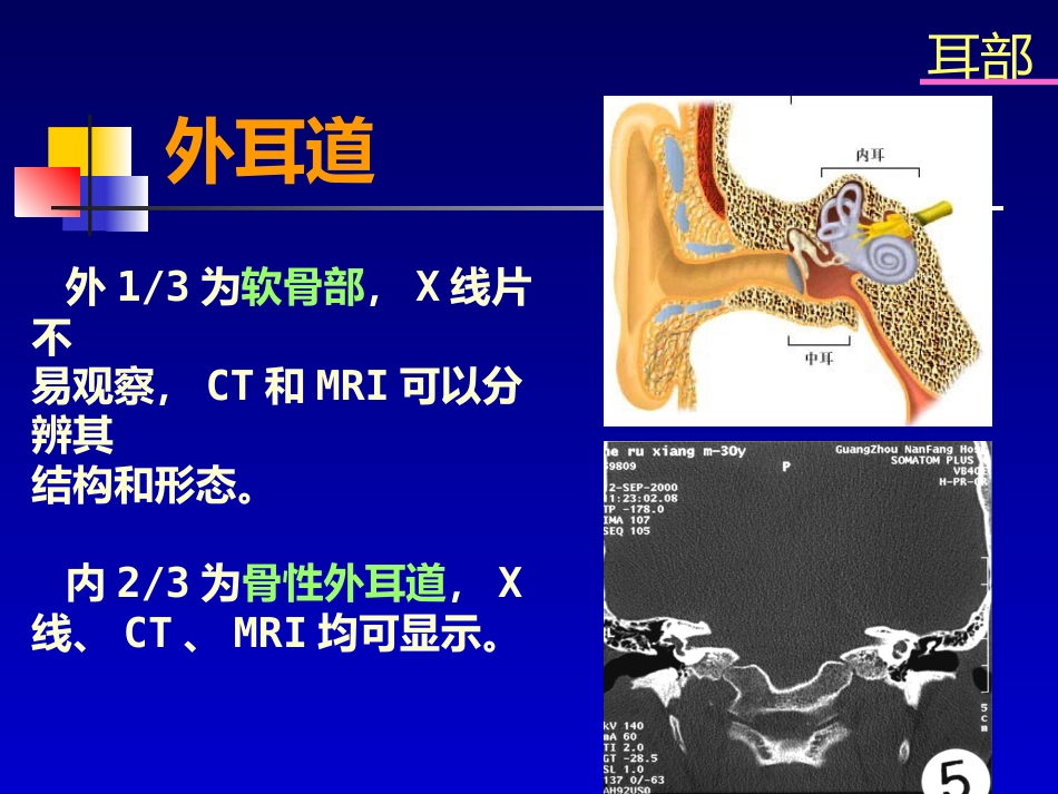 耳部病变MR诊断_第6页