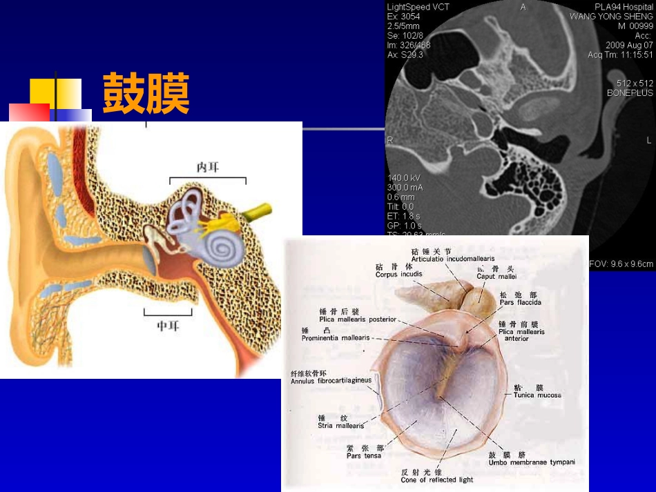 耳部病变MR诊断_第7页