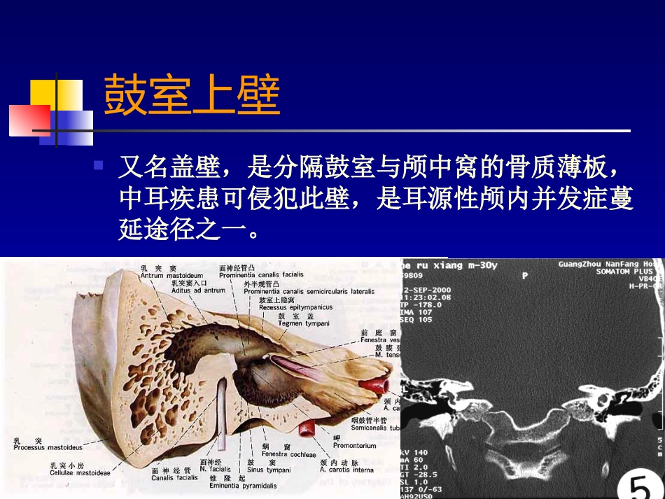 耳部病变MR诊断_第9页