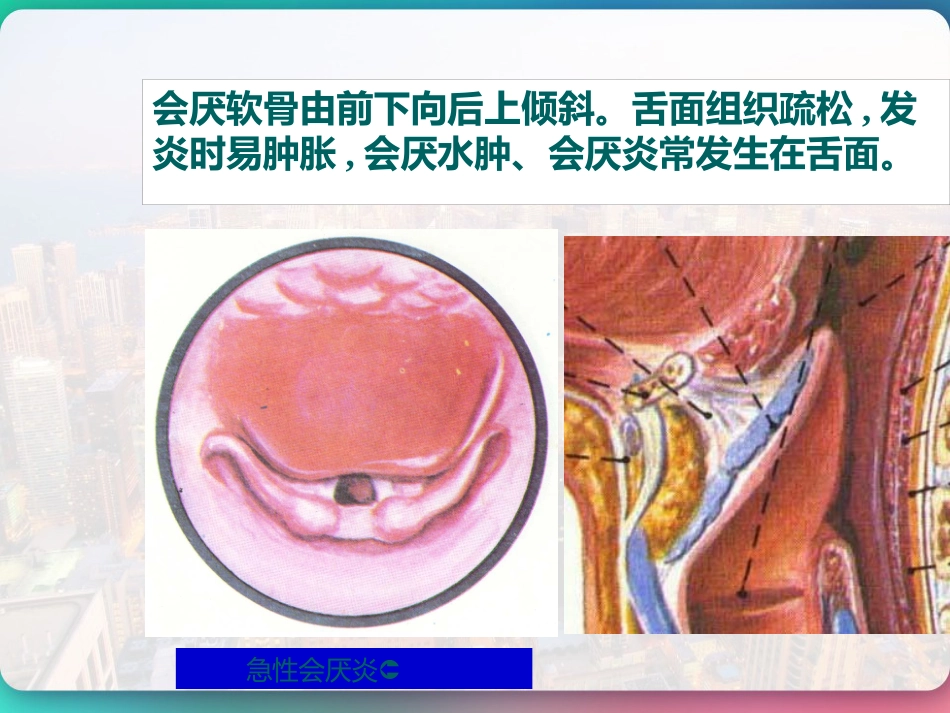 喉部的解剖 PPT_第13页