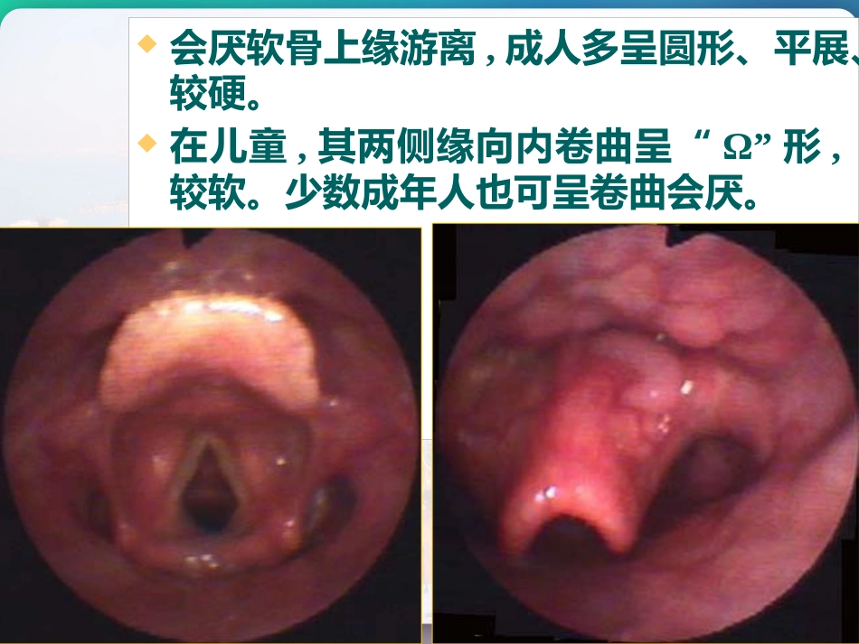 喉部的解剖 PPT_第14页