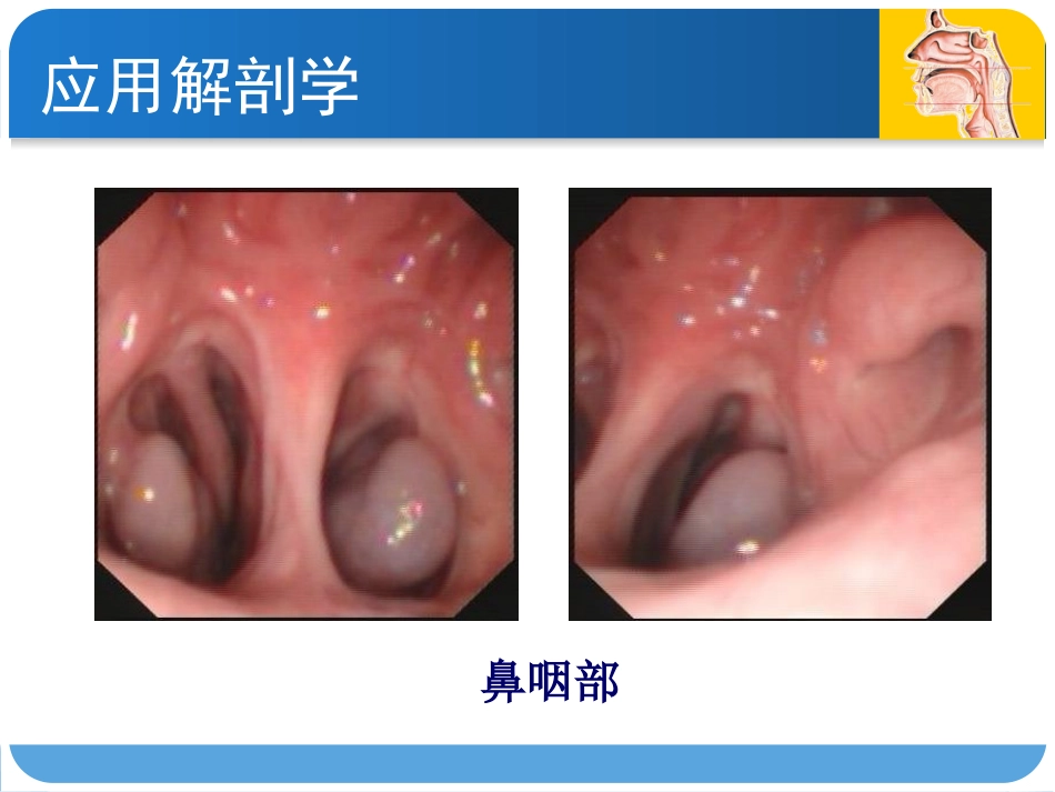 耳鼻咽喉头颈外科咽科学_第6页