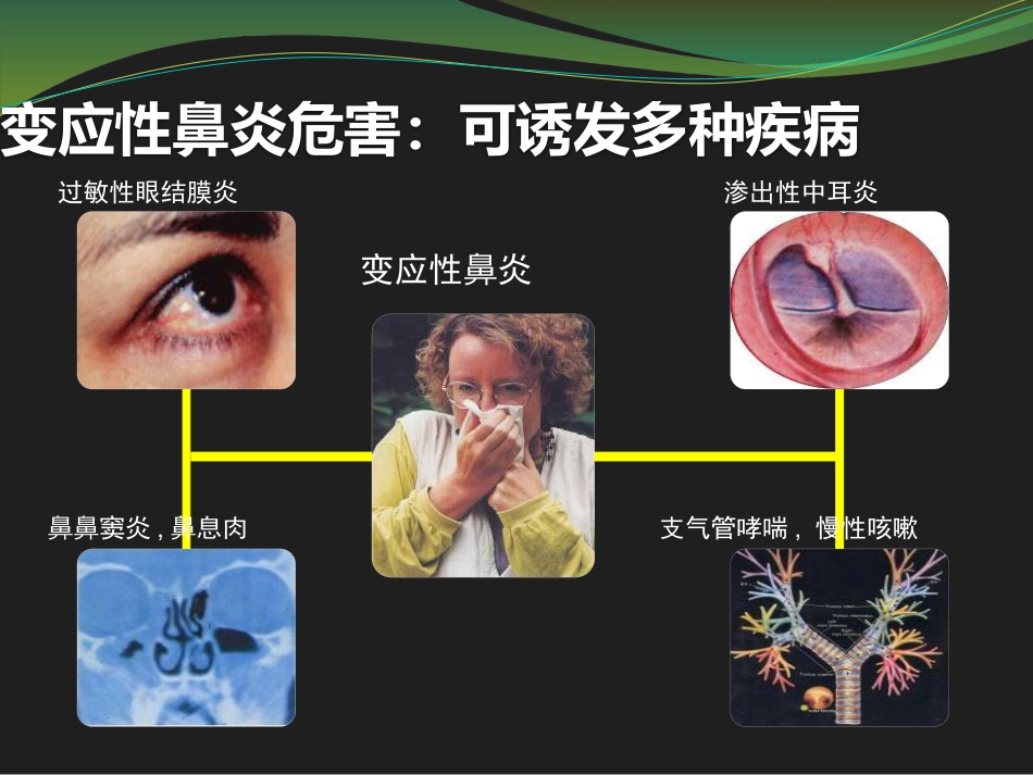 鼻用激素是治疗变应性鼻炎最有效的药物_第9页