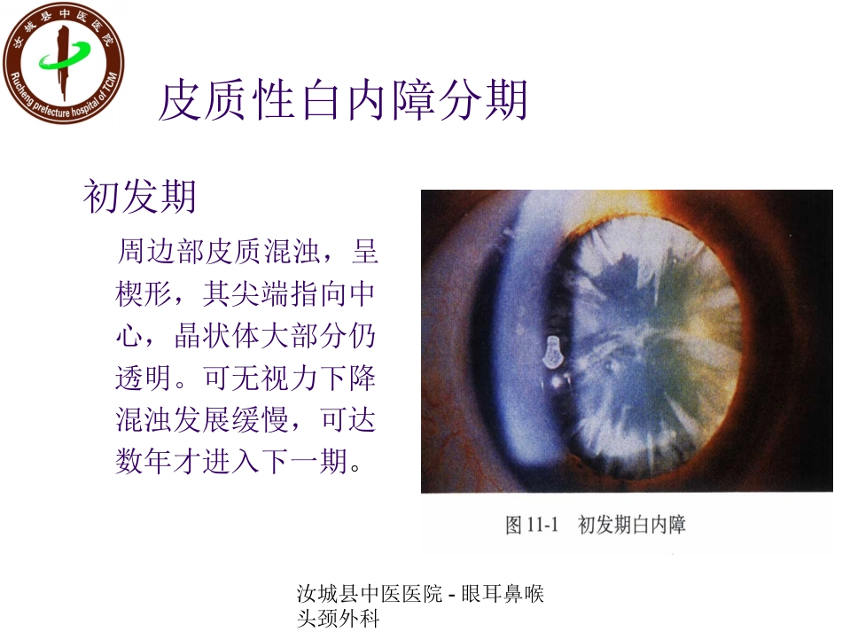 白内障患者的护理查房_第14页