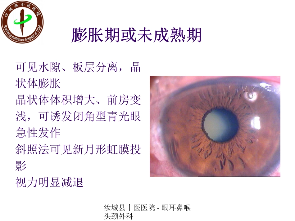 白内障患者的护理查房_第15页