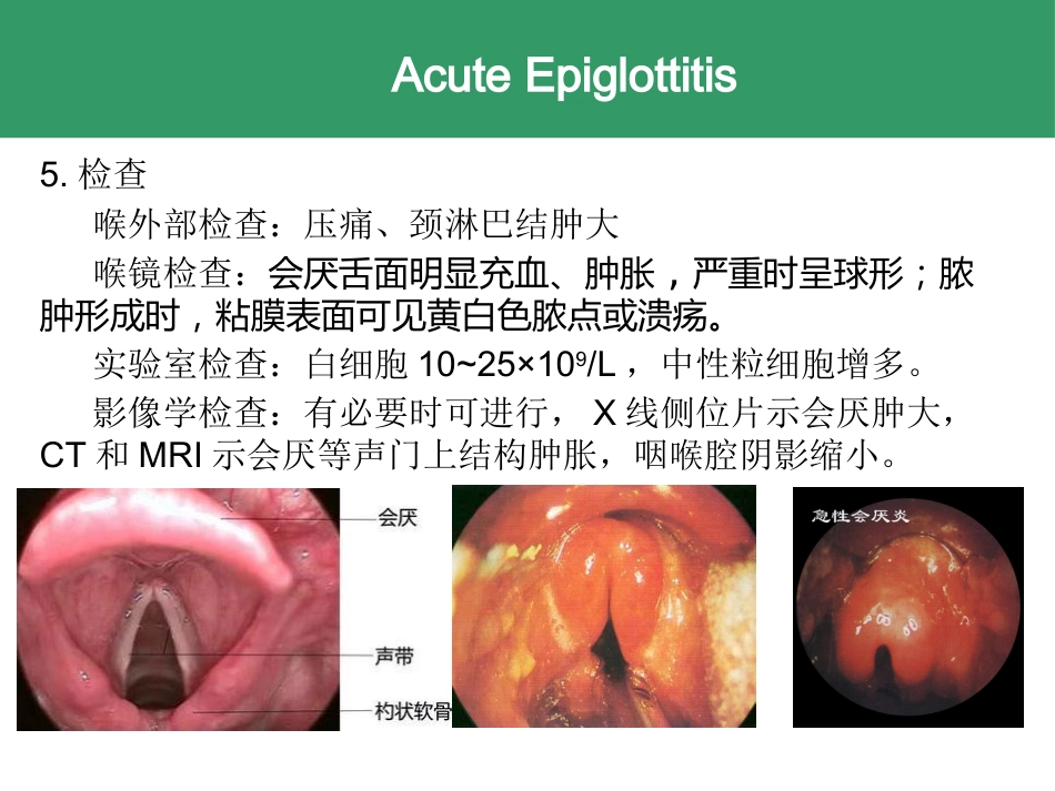 喉的急慢性炎症性疾病_第8页