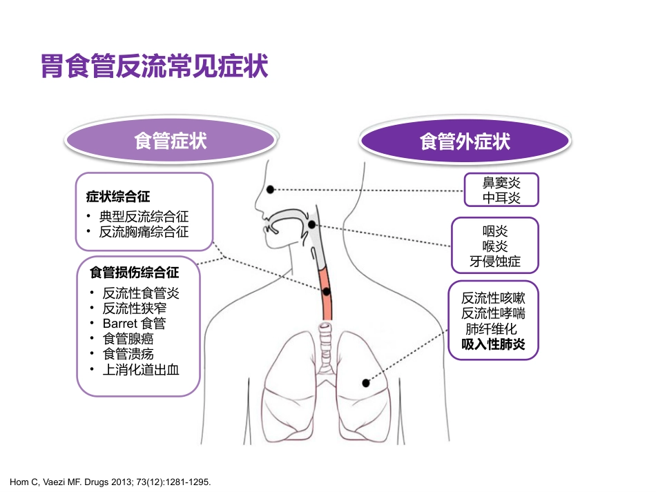 慢性咽喉炎与咽喉反流_第4页