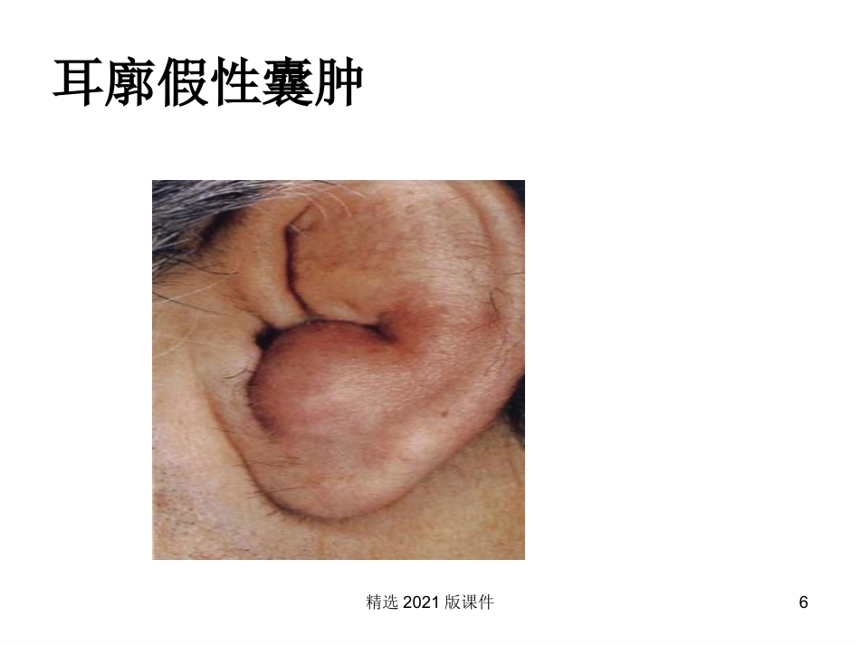 耳解剖及生理_第6页