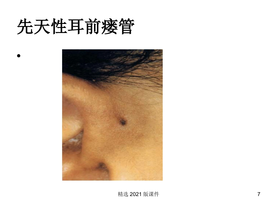 耳解剖及生理_第7页