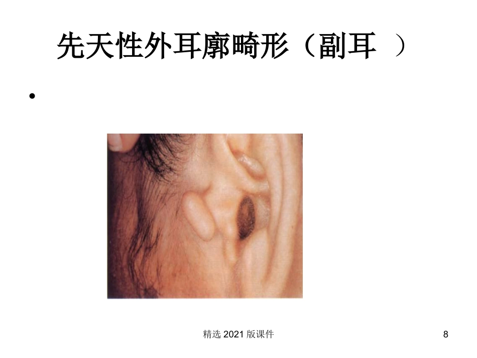 耳解剖及生理_第8页