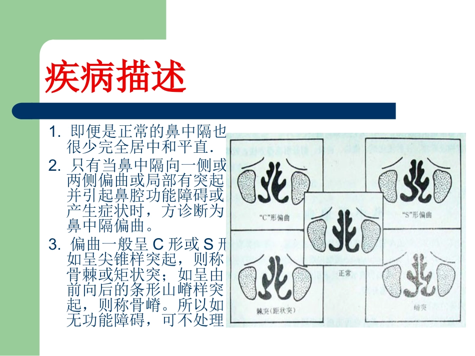 鼻中隔偏曲_第3页