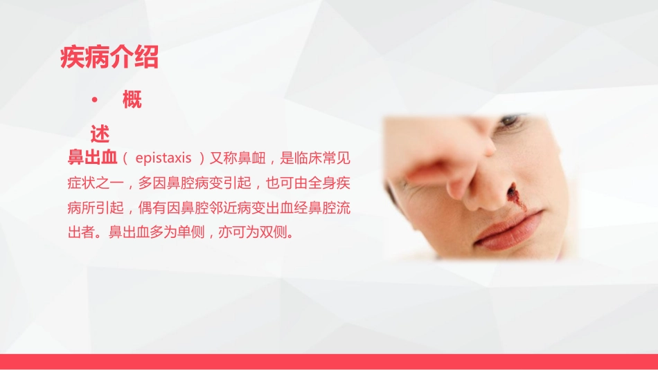 鼻出血的业务学习_第4页