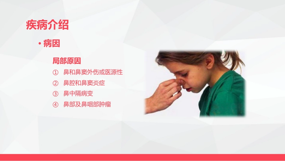鼻出血的业务学习_第8页