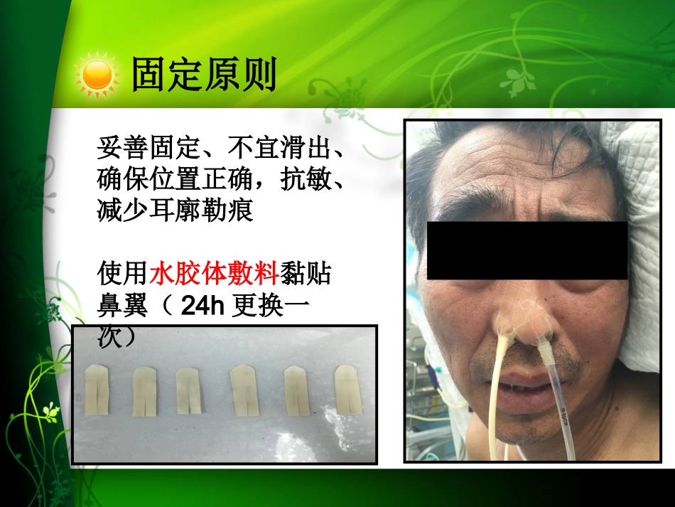 鼻肠管喂养中的注意事项及不良事件的处理_第13页