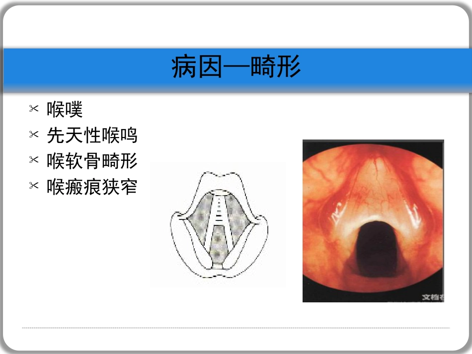 喉梗阻_第10页