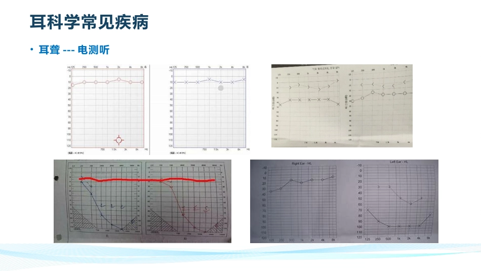 耳鼻喉常见疾病_第10页