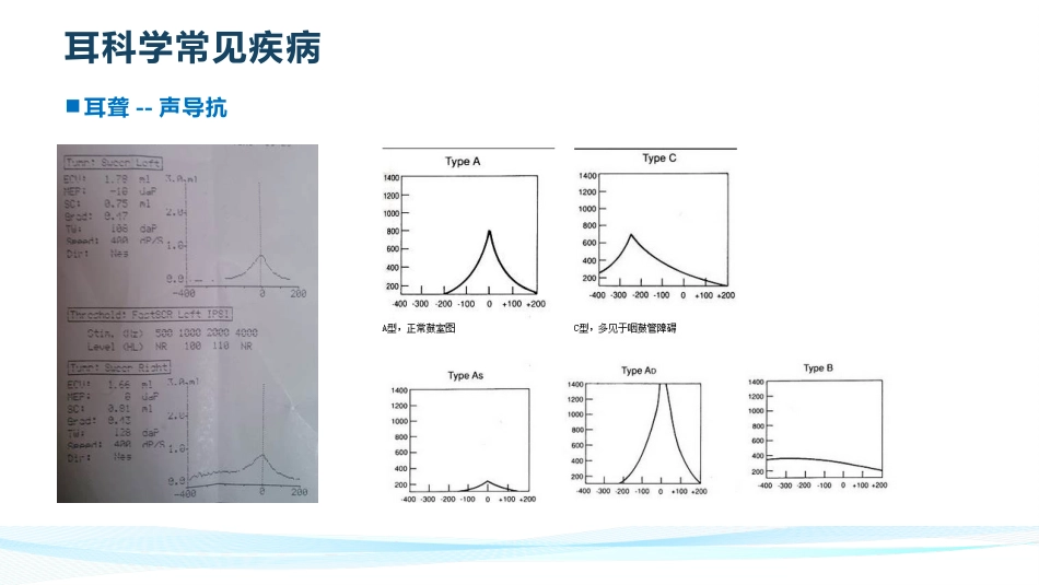 耳鼻喉常见疾病_第11页