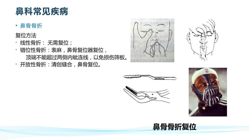 耳鼻喉常见疾病_第15页