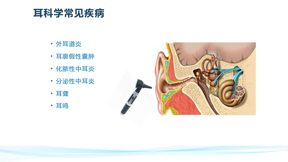 耳鼻喉常见疾病_第3页