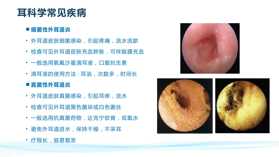 耳鼻喉常见疾病_第4页