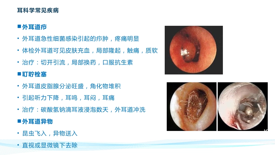 耳鼻喉常见疾病_第5页