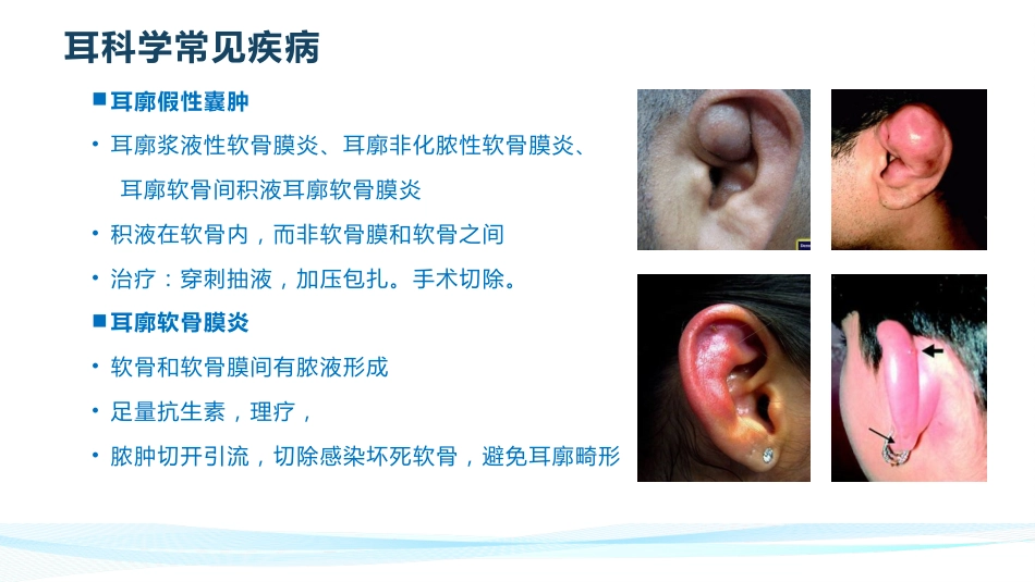 耳鼻喉常见疾病_第6页