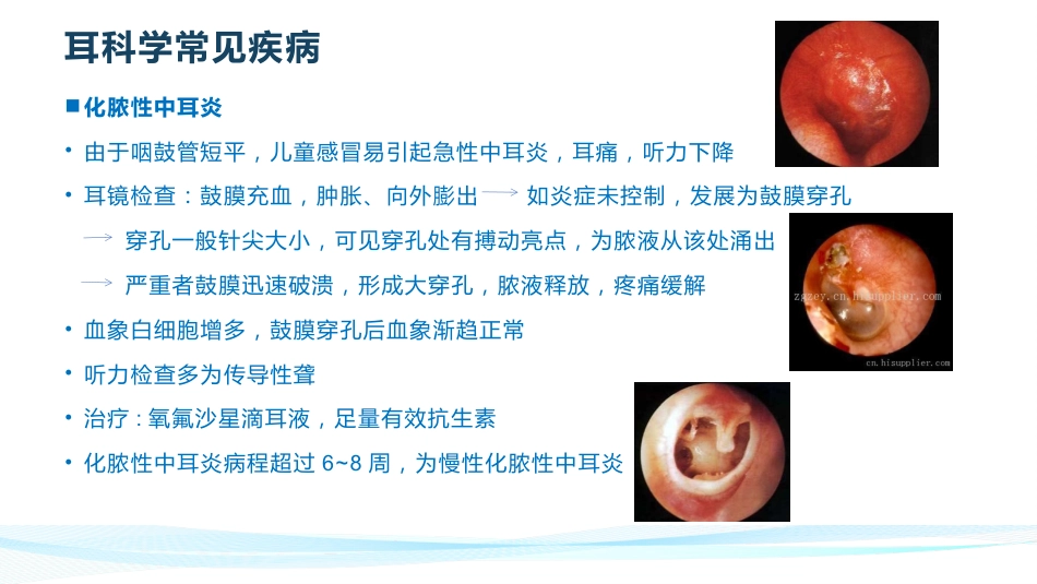 耳鼻喉常见疾病_第7页